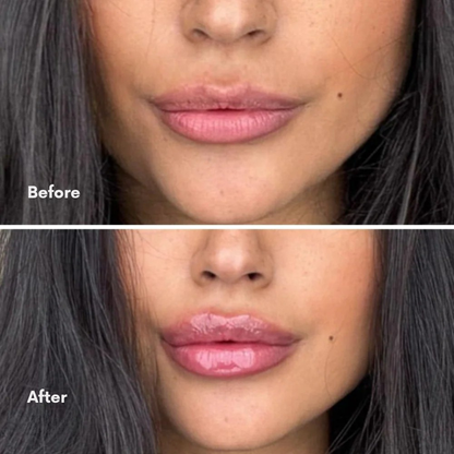 Celarazen™ Lip Plumper